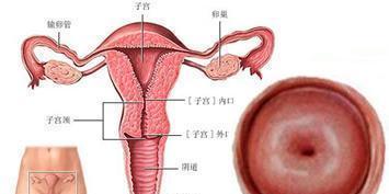 导致急性宫颈炎的原因有哪些