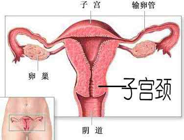 得了宫颈炎会导致什么危害?