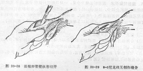 输卵管造影后出血正常吗