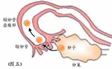 急性输卵管炎不治疗会怎样