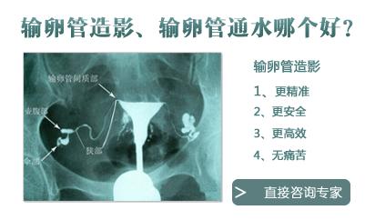 输卵管造影和通液的区别,都有啥?