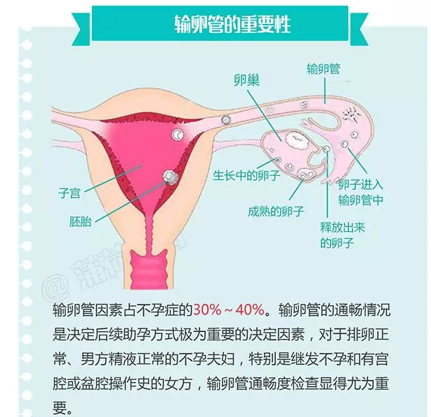 不孕检查:输卵管造影有副作用吗?