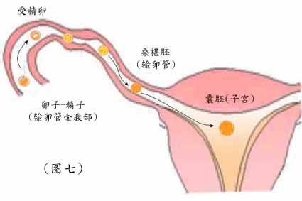 输卵管不通对女性怀孕影响有多大